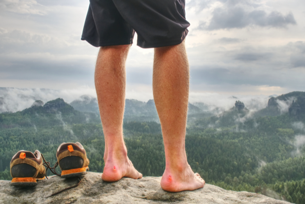 The Best Ways to Prevent Blisters while hiking