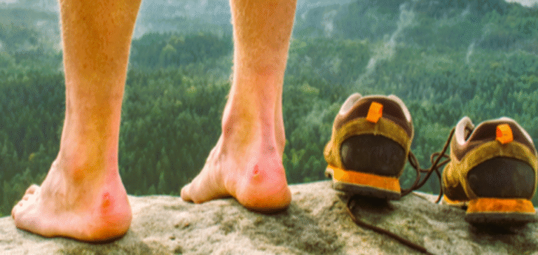 Prevent Blisters