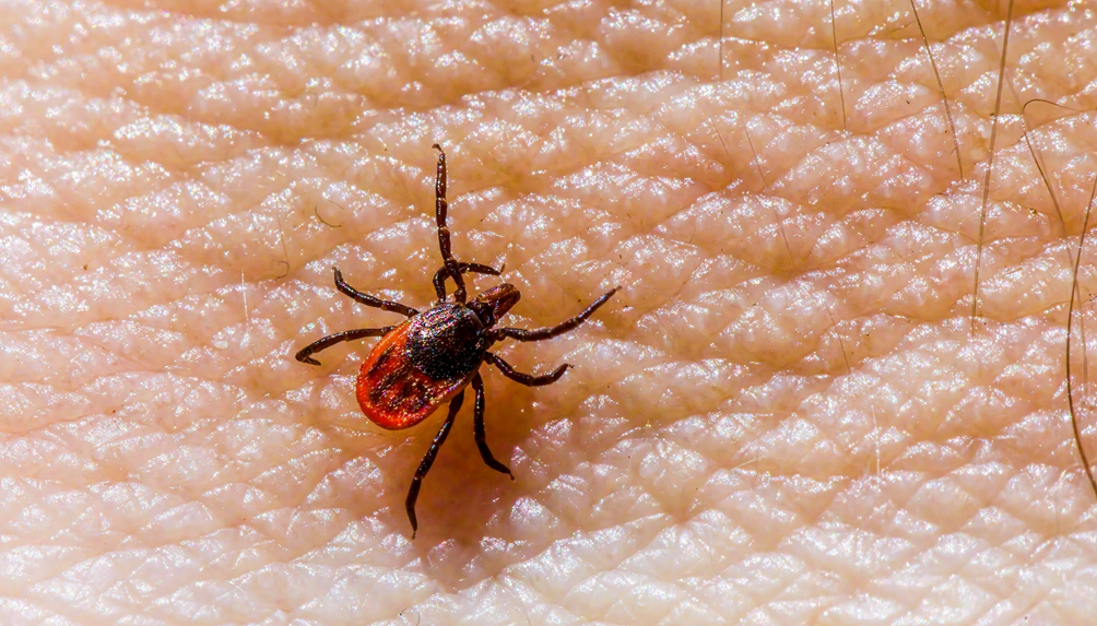 ticks while hiking